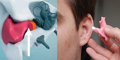 digital hearing aid devices