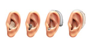 Best Audiologist Consultations for Hearing Devices