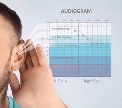 Why Accurate Results Matter in Hearing Tests